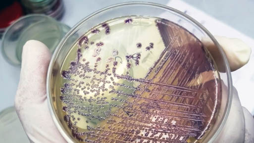 antimicrobianos